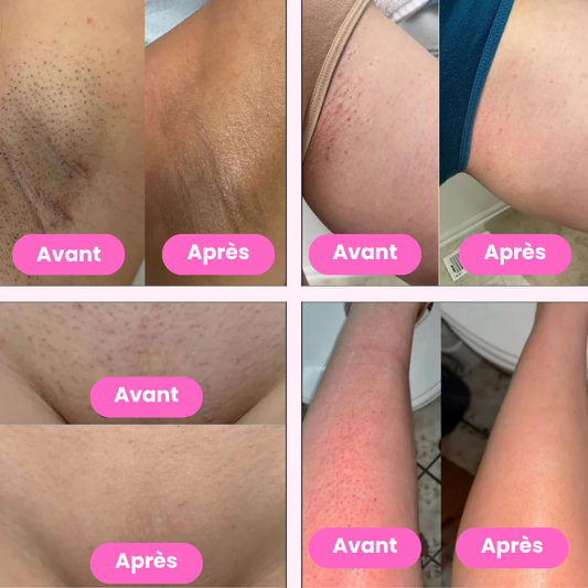 Lady Shaver âą Ăpilateur Ălectrique